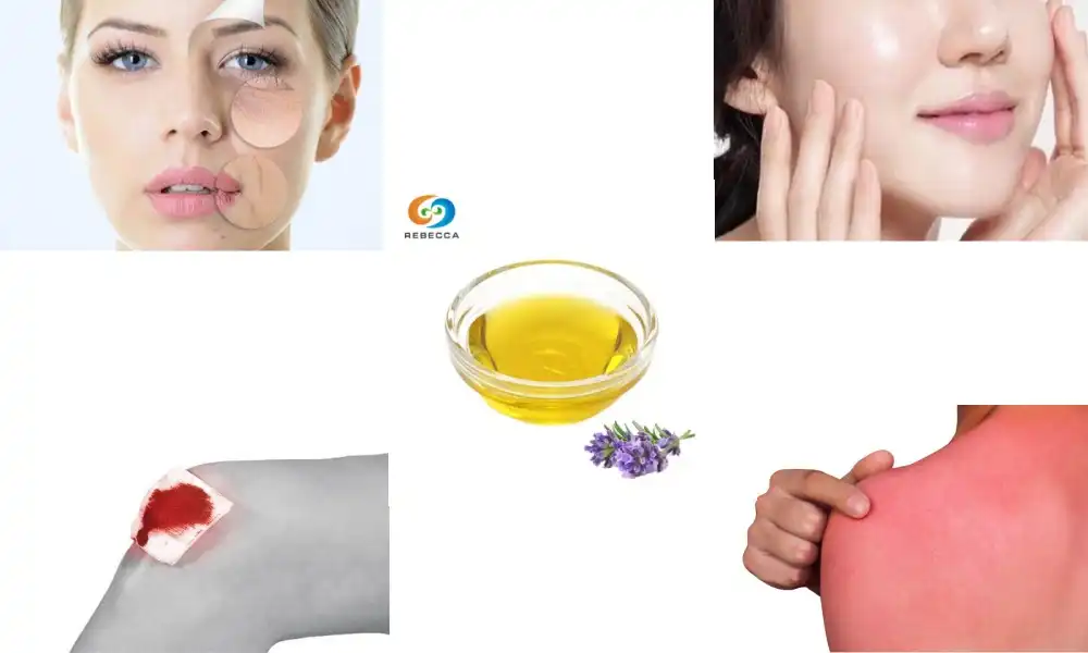 Can I apply lavender essential oil directly to skin?